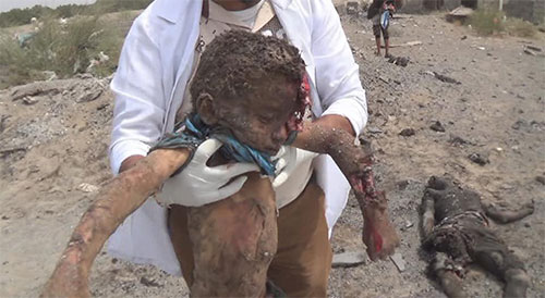 Nueva masacre de la agresión Saudí en Yemen